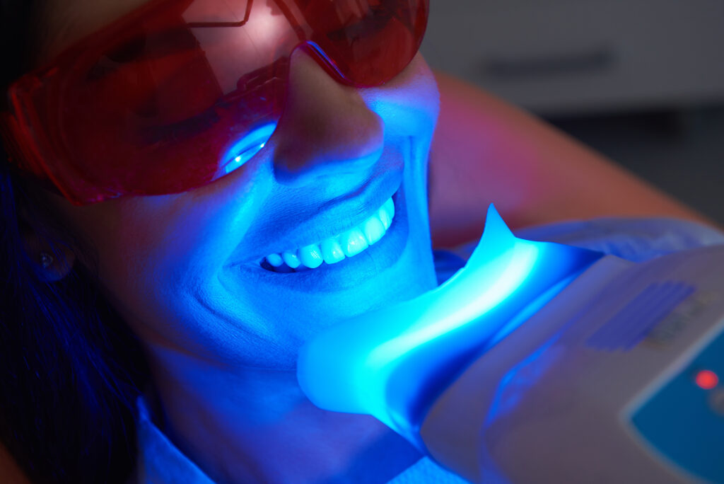 Teeth whitening maintenance at Perth City Dental