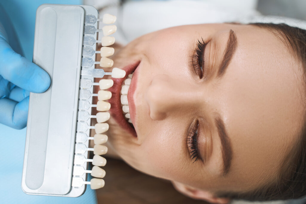 Veneer choices from Perth City Dental