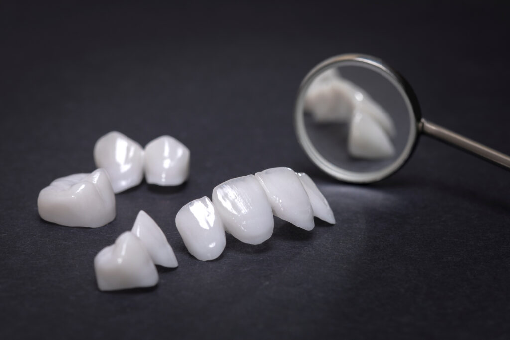 composite bonding