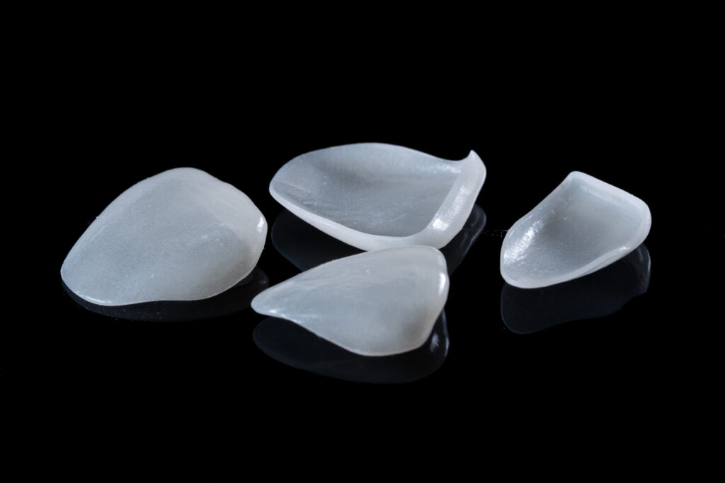how strong are porcelain veneers